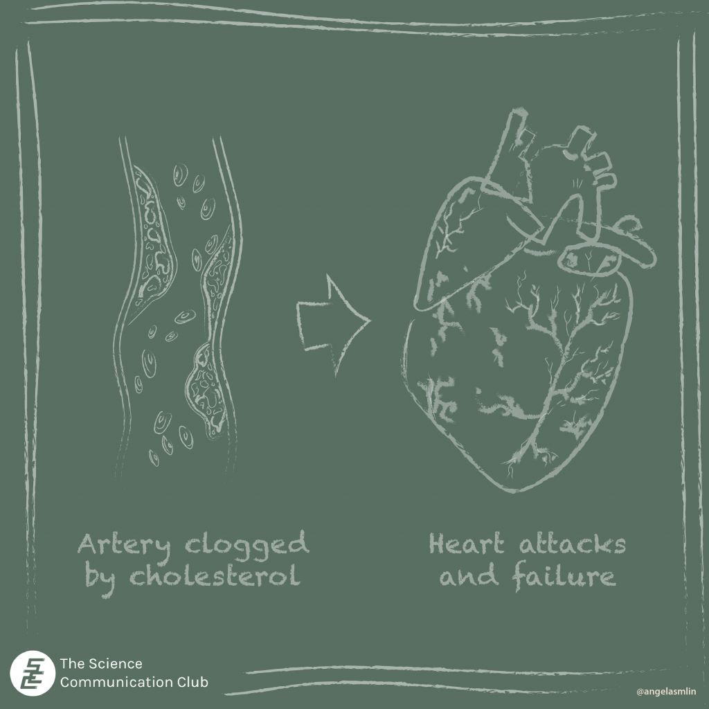Chalkboard illustration of a clogged artery with the caption ‘artery clogged by cholesterol’ beside an arrow pointing towards a heart, with the caption ‘heart attacks and failure’.