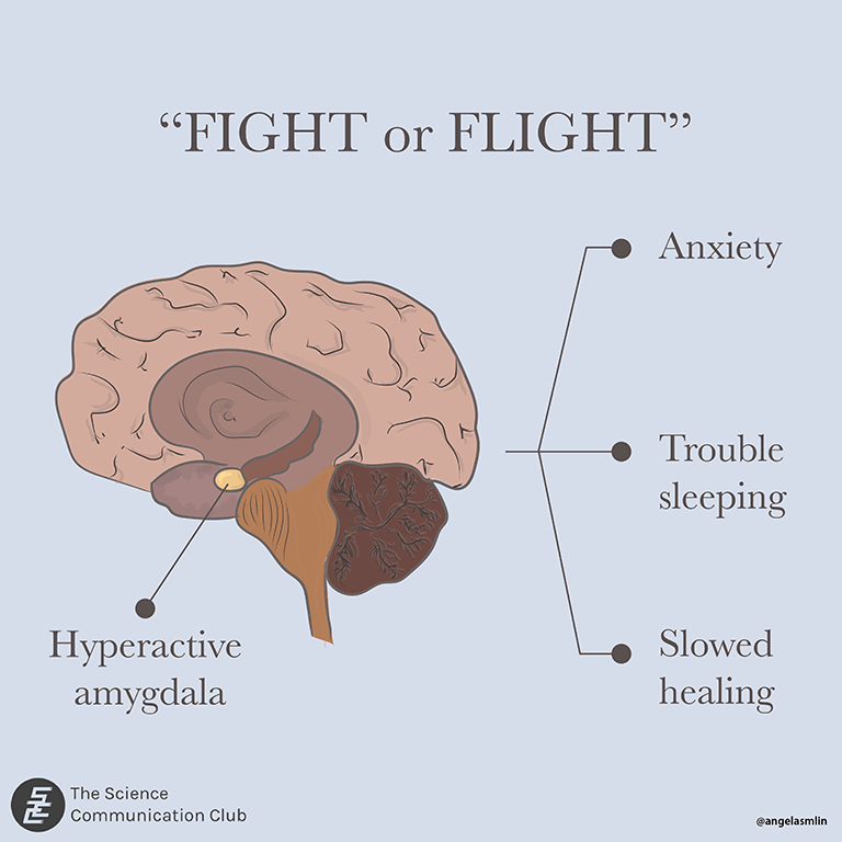 “Fight or flight” is written across the top with a diagram of the brain drawn below on the left and the amygdala is labelled. Symptoms (i.e. anxiety, trouble sleeping, slowed healing) due to a hyperactive amygdala are listed on the right of the brain illustration.