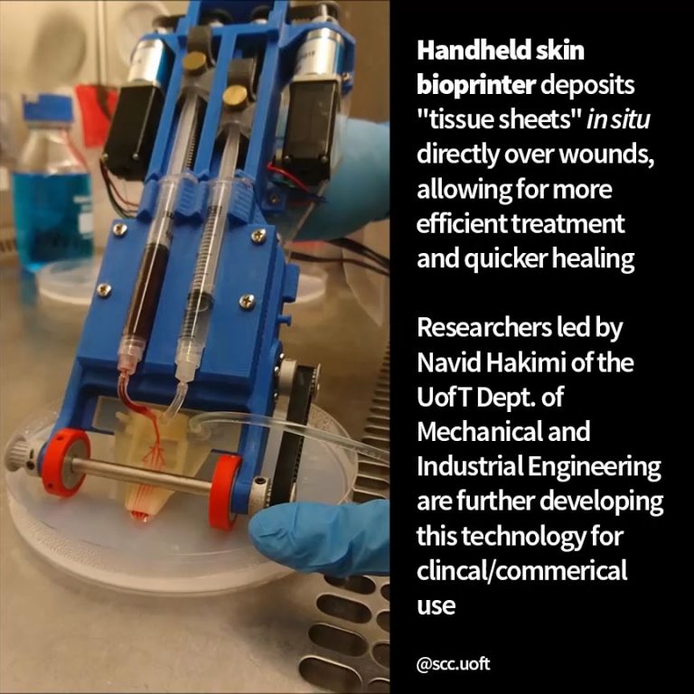 A photo of a handheld skin bioprinter. Handheld skin bioprinters deposit "tissue sheets" in situ directly over wounds, allowing for more efficient treatment and quicker healing. Researchers led by Navid Hakimi of the UofT Dept. of Mechanical and Industrial Engineering are further developing this technology for clinical/commercial use.