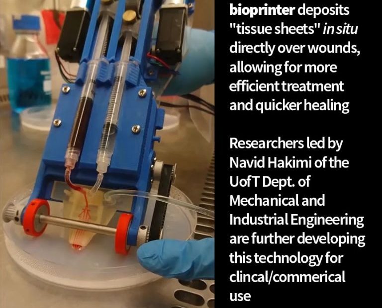 A photo of a handheld skin bioprinter. Handheld skin bioprinters deposit "tissue sheets" in situ directly over wounds, allowing for more efficient treatment and quicker healing. Researchers led by Navid Hakimi of the UofT Dept. of Mechanical and Industrial Engineering are further developing this technology for clinical/commercial use.